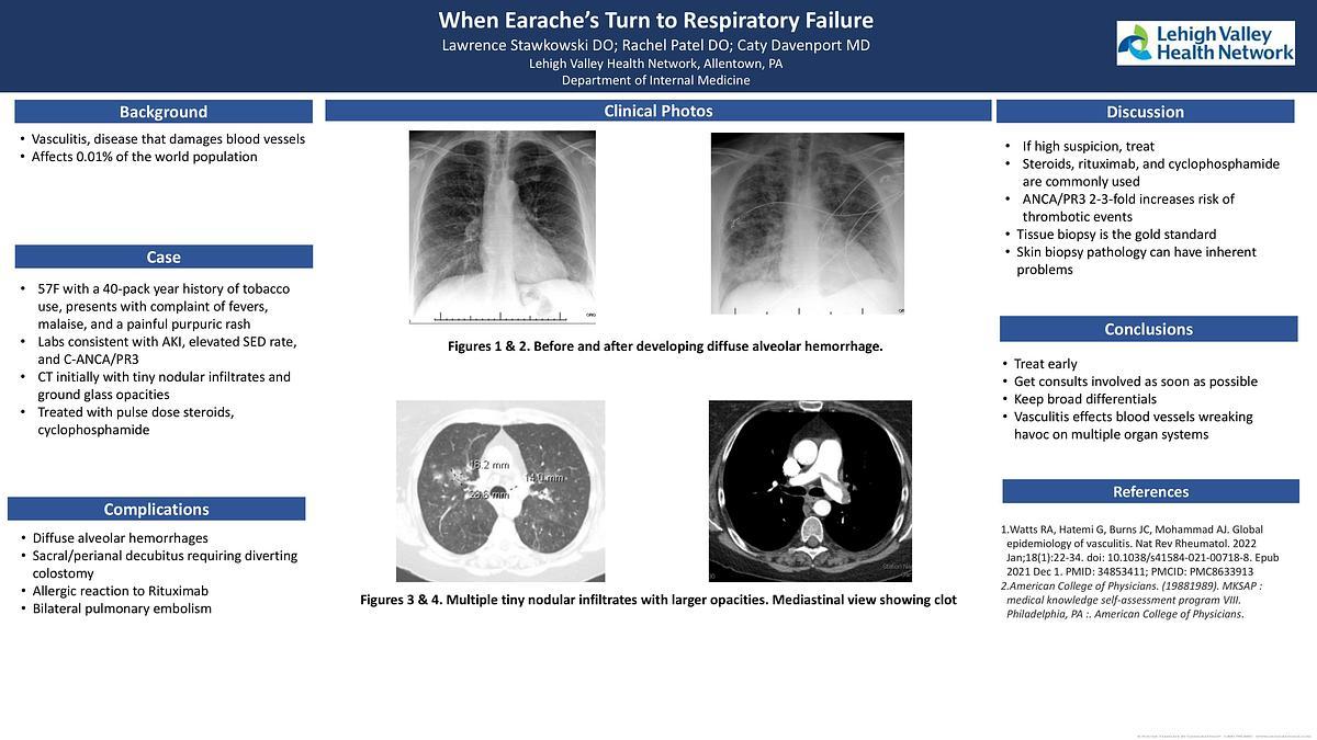 Lecture image placeholder