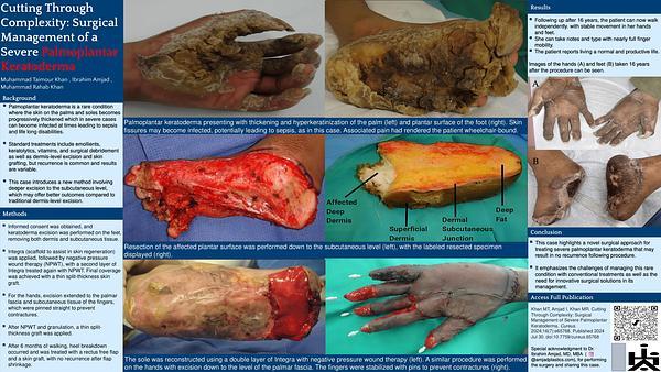 Cutting Through Complexity: Surgical Management of a Severe Palmoplantar Keratoderma