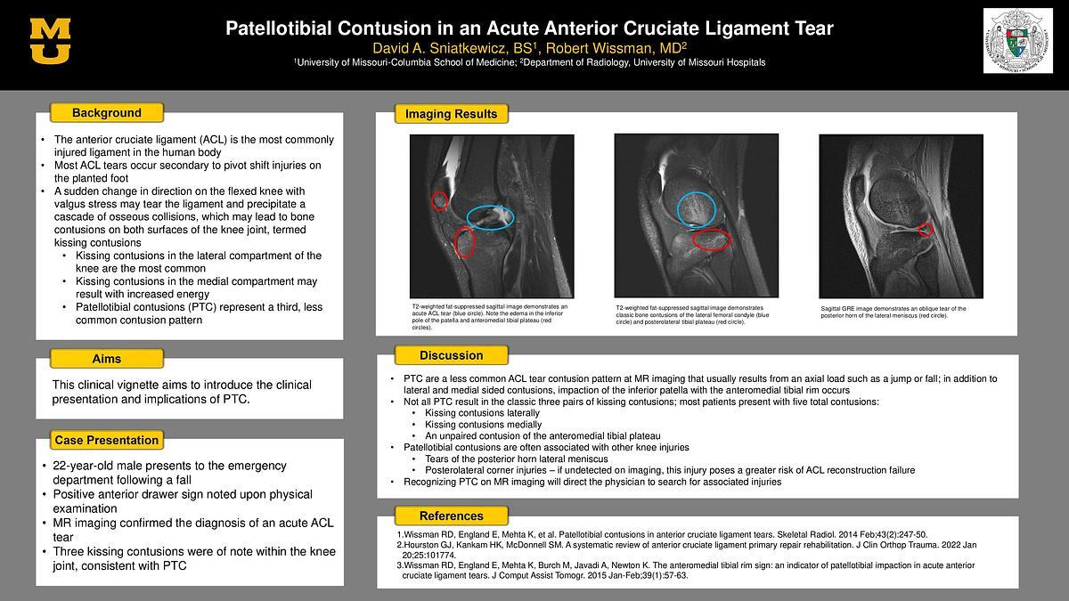 Lecture image placeholder
