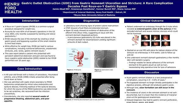 Gastric Outlet Obstruction from Remnant Ulceration and Stricture: A Rare Complication Post RYGB