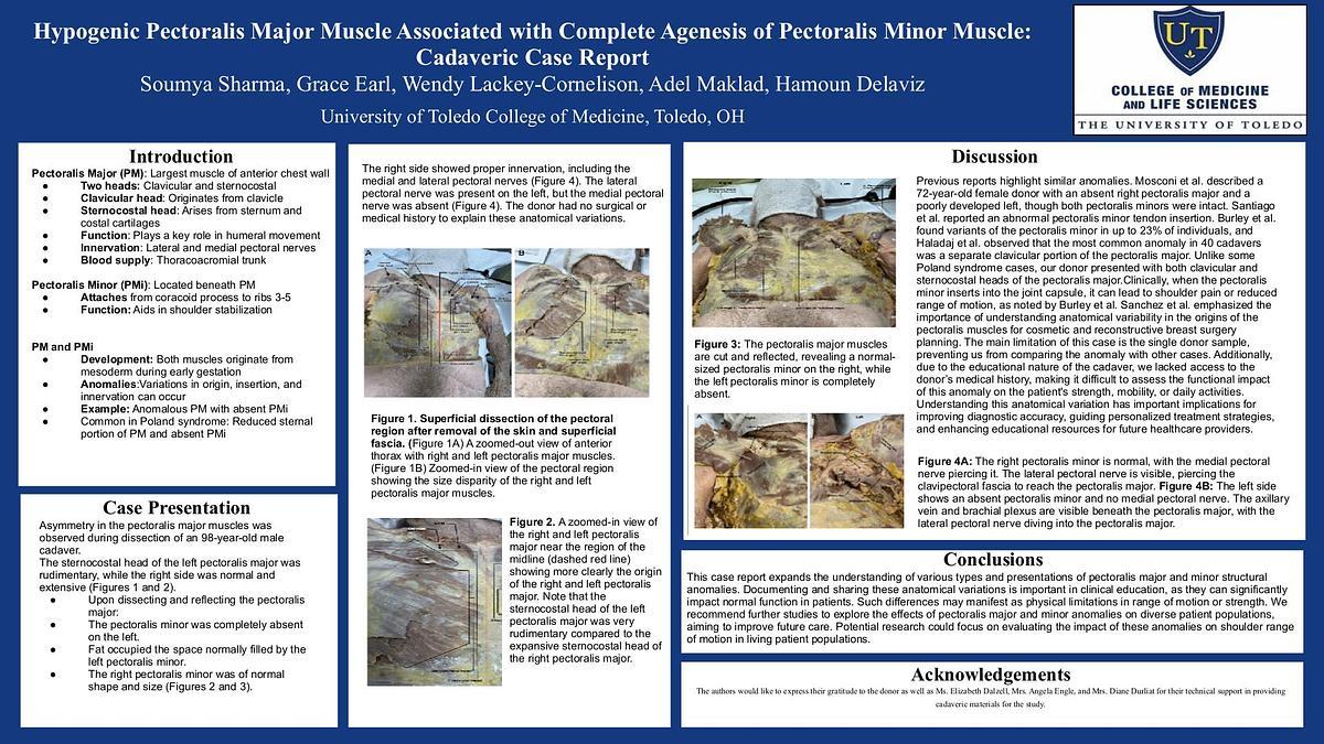 Lecture image placeholder