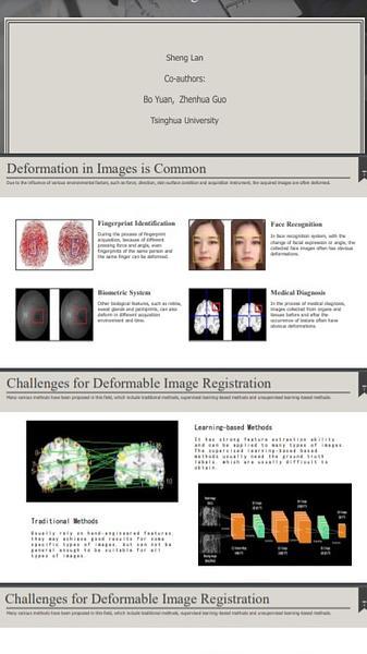 A Joint Super-Resolution and Deformable Registration Network for 3D Brain Images