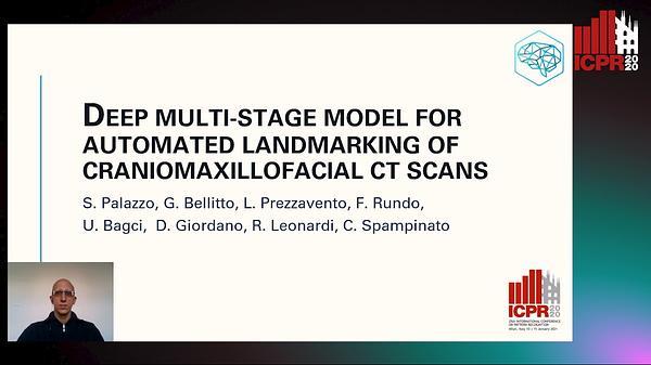Deep Multi-stage Model for Automated Landmarking of Craniomaxillofacial Ct Scans
