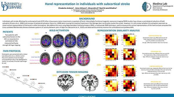 Hand representation in individuals with subcortical stroke
