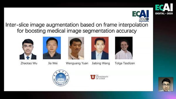 Inter-Slice image augmentation based on fame interpolation for boosting medical image segmentation accuracy