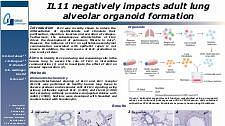 IL11 negatively impacts adult lung alveolar organoid formation