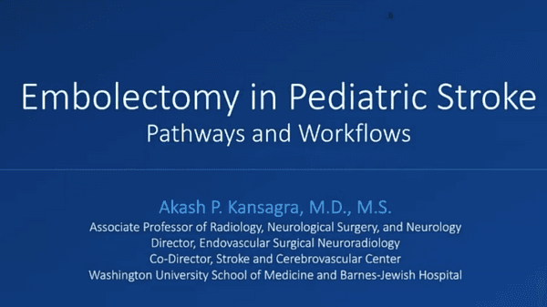 Embolectomy in pediatric stroke: who, when, where, why - Akash Kansagra