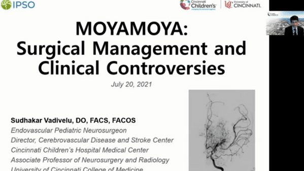 Medical and surgical management of moyamoya - Sudhakar Vadivelu