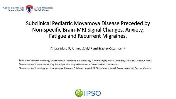 Subclinical pediatric moyamoya disease preceded by non-specific brain-MRI signal changes, anxiety, fatigue and recurrent migraines