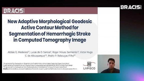 New Adaptive Morphological Geodesic Active Contour Method for Segmentation of Hemorrhagic Stroke in Computed Tomography Image