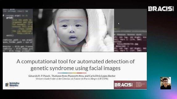 A computational tool for automated detection of genetic syndrome using facial images