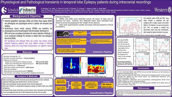Physiological and Pathological transients in temporal lobe Epilepsy patients during intracranial recordings