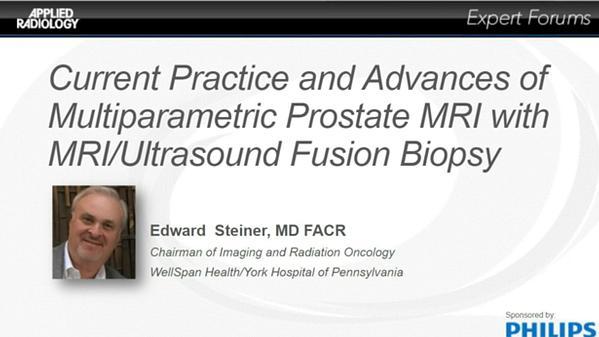 Current Practice and Advances of Multiparametric Prostate MRI with MRI/US Fusion Biopsy