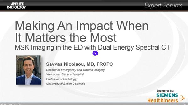 Making an Impact When it Matters the Most: MSK Imaging in the ED with Dual Energy Spectral CT
