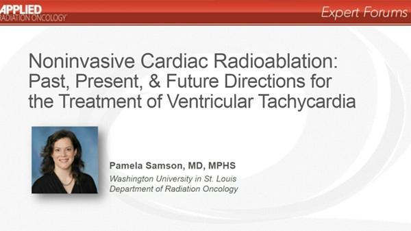 Noninvasive Cardiac Radioablation: Past, Present, & Future Directions for the Treatment of Ventricular Tachycardia