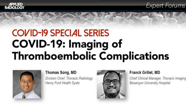 COVID-19: Imaging of Thromboembolic Complications
