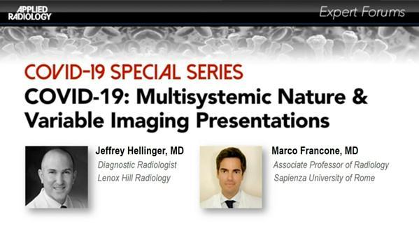 COVID-19: Multisystemic Nature & Variable Imaging Presentations
