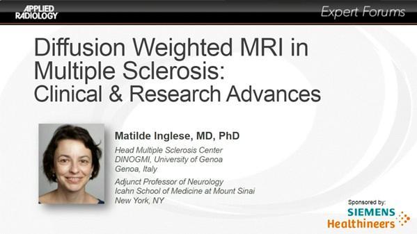 Diffusion Weighted MRI in Multiple Sclerosis: Clinical & Research Advances