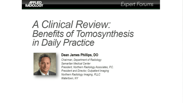 A Clinical Review: Benefits of Tomosynthesis in Daily Practice