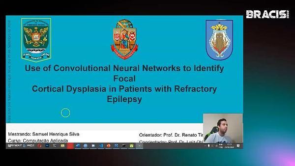 Use of Convolutional Neural Networks to Identify Focal Cortical Dysplasia in Patients with Refractory Epilepsy