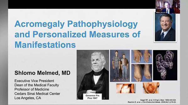 Acromegaly Pathophysiology and Personalized Measures of Manifestations