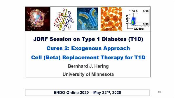 Cures 2: Exogenous Approach - Cell (Beta) Replacement Therapy for T1D