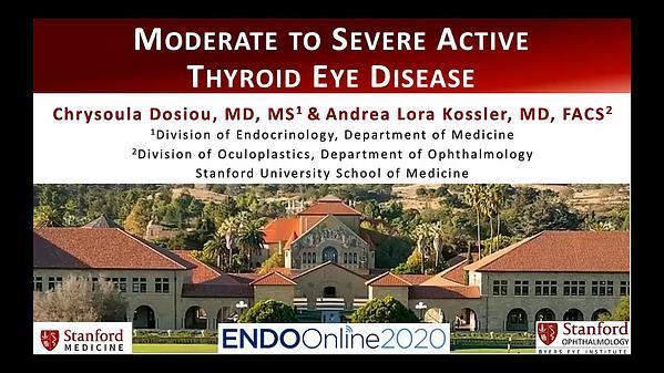 Moderate to Severe Active Thyroid Eye Disease