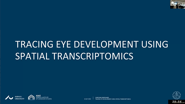 Tracing the development of the eye using spatial transcriptomics