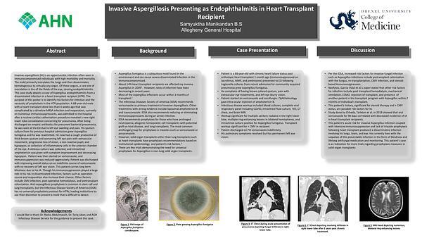 Invasive Aspergillosis Presenting as Endophthalmitis in Heart Transplant Recipient