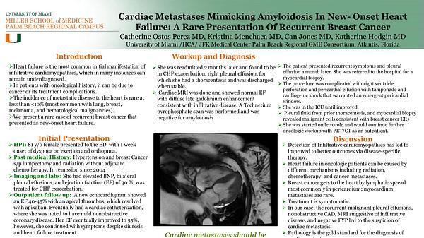 Cardiac Metastases Mimicking Amyloidosis In New- Onset Heart Failure: A Rare Presentation Of Recurrent Breast Cancer