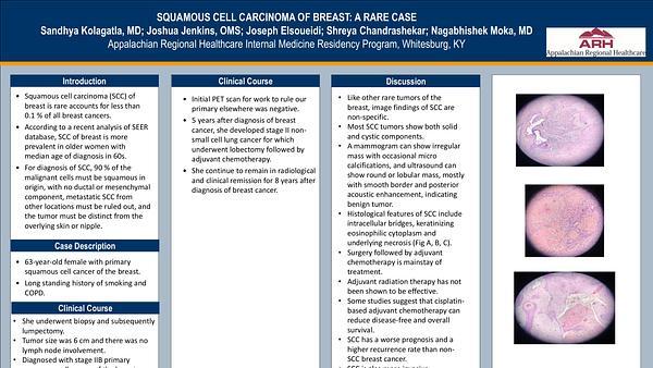 Squamous Cell Carcinoma of Breast: a Rare Case