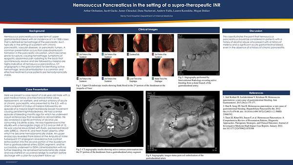 Hemosuccus Pancreaticus in the setting of a supra-therapeutic INR