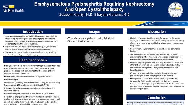 Emphysematous pyelonephritis requiring nephrectomy and open cystolitholapaxy