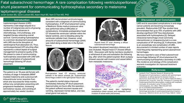 Fatal subarachnoid hemorrhage: A rare complication following ventriculoperitoneal shunt placement for communicating hydrocephalus secondary to melanoma leptomeningeal disease