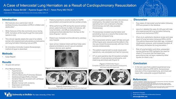 A Case of Intercostal Lung Herniation as a Result of Cardiopulmonary Resuscitation