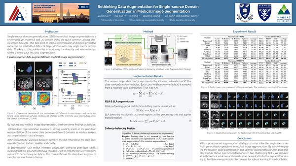 Rethinking Data Augmentation for Single-source Domain Generalization in Medical Image Segmentation