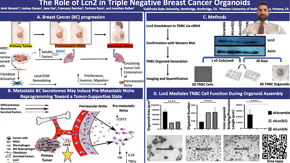 The role of Lcn2 in Triple Negative Breast Cancer Organoids