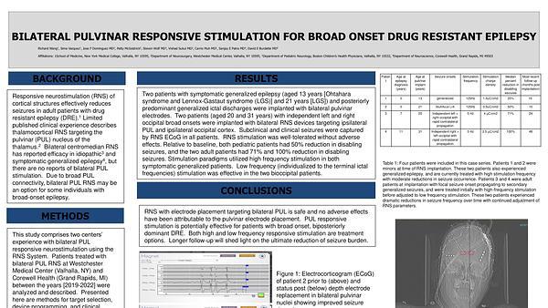 Bilateral Pulvinar Responsive Stimulation for Broad Onset Drug Resistant Epilepsy
