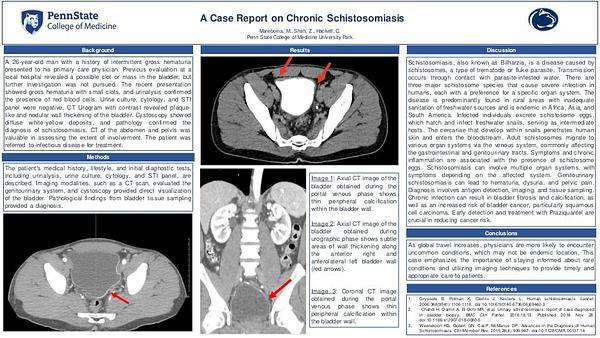 A Case Report on Chronic Schistosomiasis
