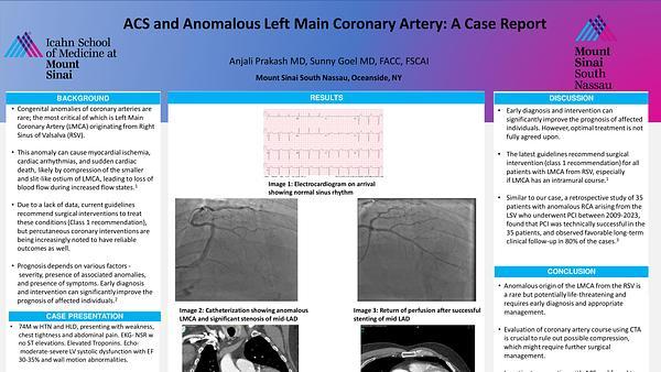 Acute Coronary Syndrome (ACS) and Anomalous Left Main Coronary Artery: A Case Report
