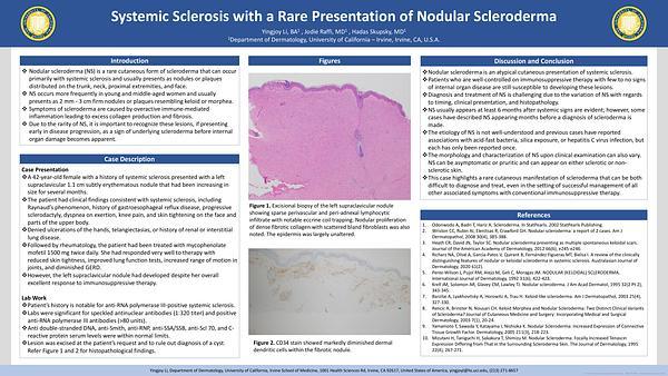Systemic Sclerosis with a Rare Presentation of Nodular Scleroderma