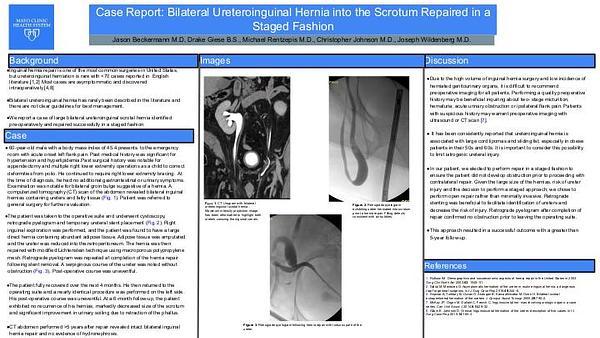 Case Report: Bilateral Ureteroinguinal hernia into the Scrotum Repaired in a Staged Fashion