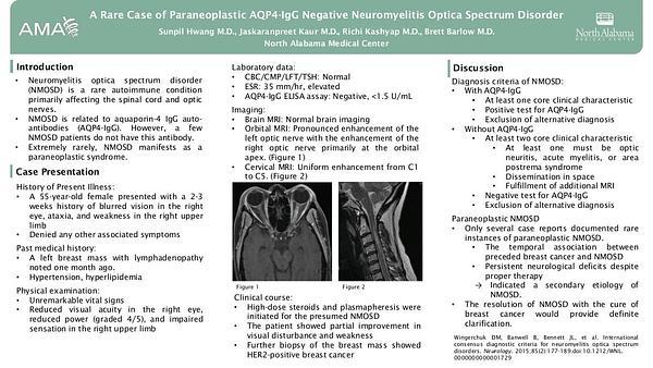 A Rare Case of Paraneoplastic AQP4-IgG Negative Neuromyelitis Optica Spectrum Disorder
