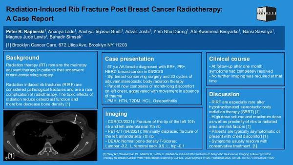 Radiation-Induced Rib Fracture Post Breast Cancer Radiotherapy: A Case Report