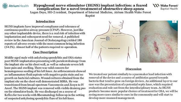 Hypoglossal nerve stimulator (HGNS) implant infection: a feared
complication for a novel treatment of obstructive sleep apnea