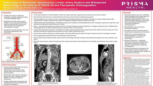 A Rare Case of Atraumatic Spontaneous Lumbar Artery Rupture and Widespread Hemorrhage in the setting of COVID-19 and Therapeutic Anticoagulation