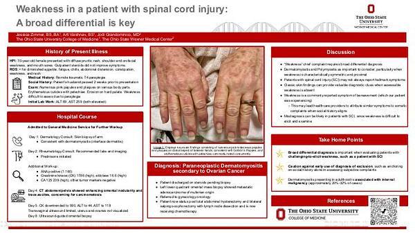 Weakness in a patient with spinal cord injury: A broad differential is key
