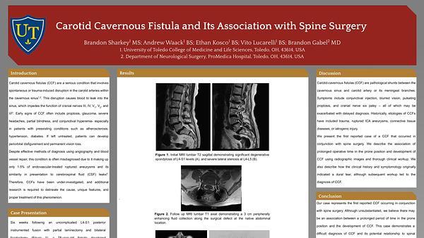 Carotid Cavernous Fistula and Its Association with Spine Surgery