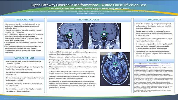 Optic Pathway Cavernous Malformations - A Rare Cause Of Vision Loss