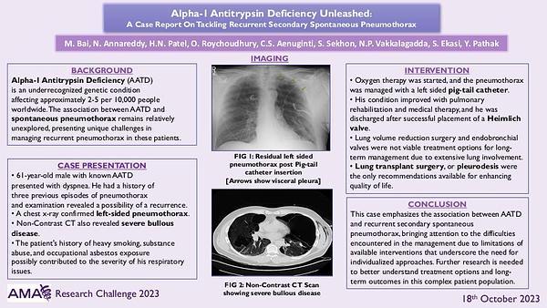 Alpha-1 Antitrypsin Deficiency Unleashed:
A Case Report On Tackling Recurrent Secondary Spontaneous Pneumothorax